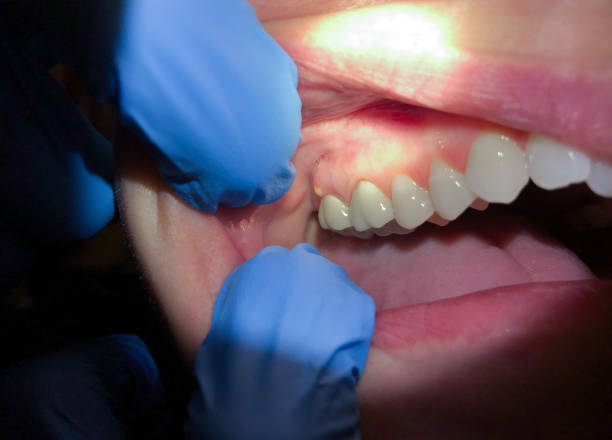 Best Pediatric Emergency Dentist in Speer, NC