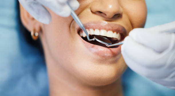 Best Mobile Emergency Dentist in Speer, NC