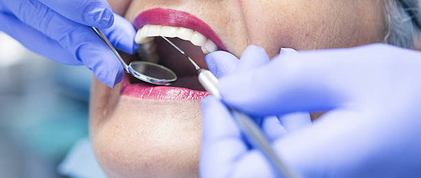 Best Emergency Root Canal Treatment in Speer, NC